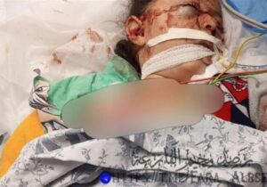 واکنش تند حماس به شهادت کودک فلسطینی توسط تشکیلات ابومازن